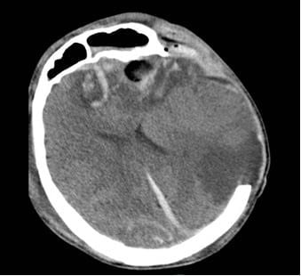 Cứu sống mẹ con du kh&aacute;ch Nga bị tai nạn nguy kịch- Ảnh 1.