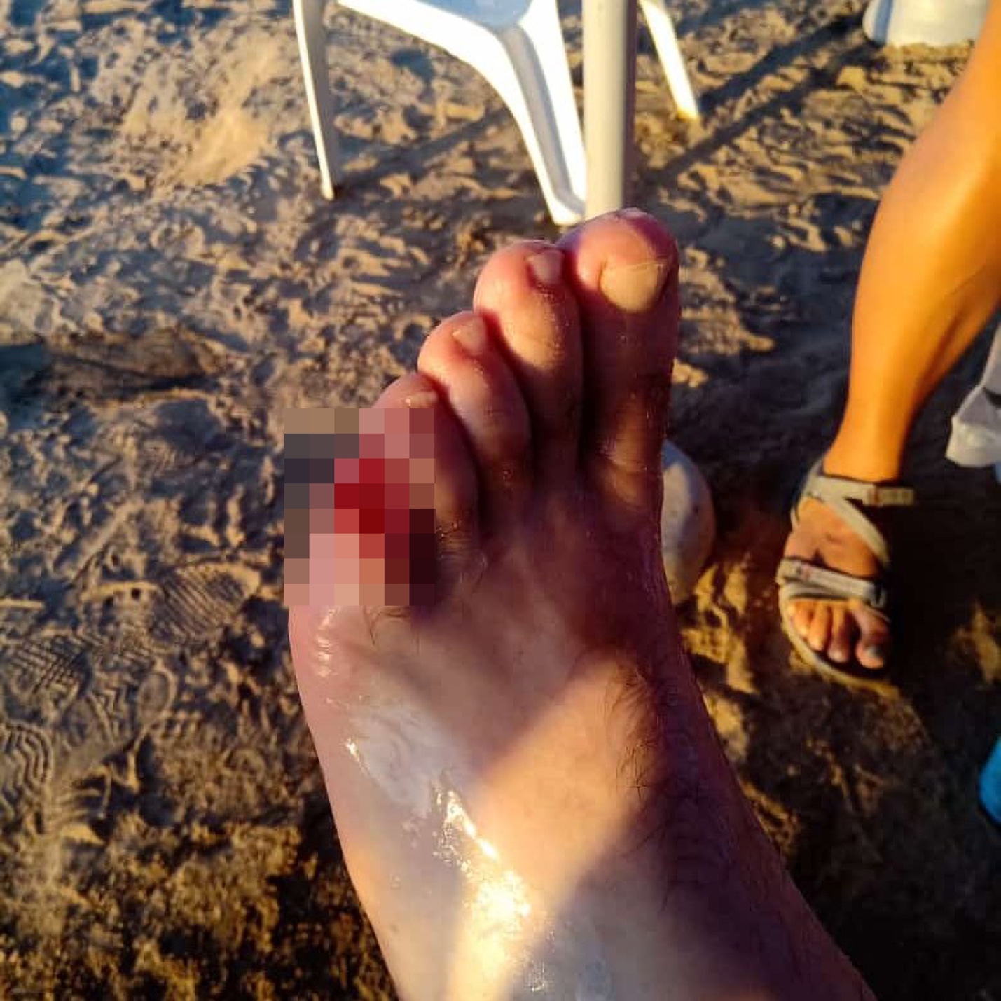 H&agrave;ng chục người bị c&aacute; ăn thịt tấn c&ocirc;ng khi tắm s&ocirc;ng ở Argentina- Ảnh 1.