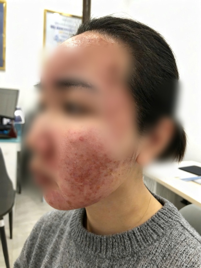 Cơn &aacute;c mộng của thiếu nữ chỉ sau v&agrave;i giờ được mời l&agrave;m đẹp cấp tốc đ&oacute;n Tết- Ảnh 1.