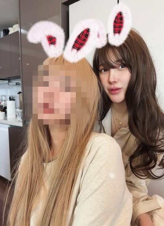 Kh&ocirc;ng c&ograve;n nhận ra nữ ca sĩ đ&igrave;nh đ&aacute;m bị chồng doanh nh&acirc;n 