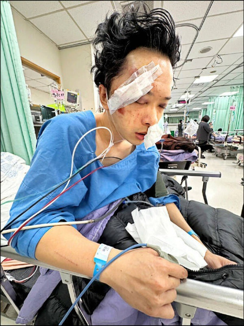 Nam diễn vi&ecirc;n T&ocirc; Đức Dương bị nạn nghi&ecirc;m trọng- Ảnh 2.