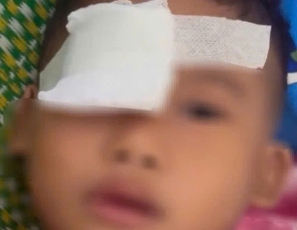Xác minh vụ phụ huynh tố con học lớp 1 bị bạn chọc trúng mắt, rách giác mạc- Ảnh 1.