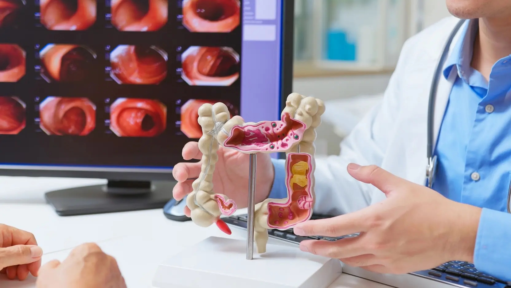 Những người dưới 50 tuổi ch&uacute; &yacute;: 6 triệu chứng n&agrave;y c&oacute; thể l&agrave; dấu hiệu của ung thư- Ảnh 2.