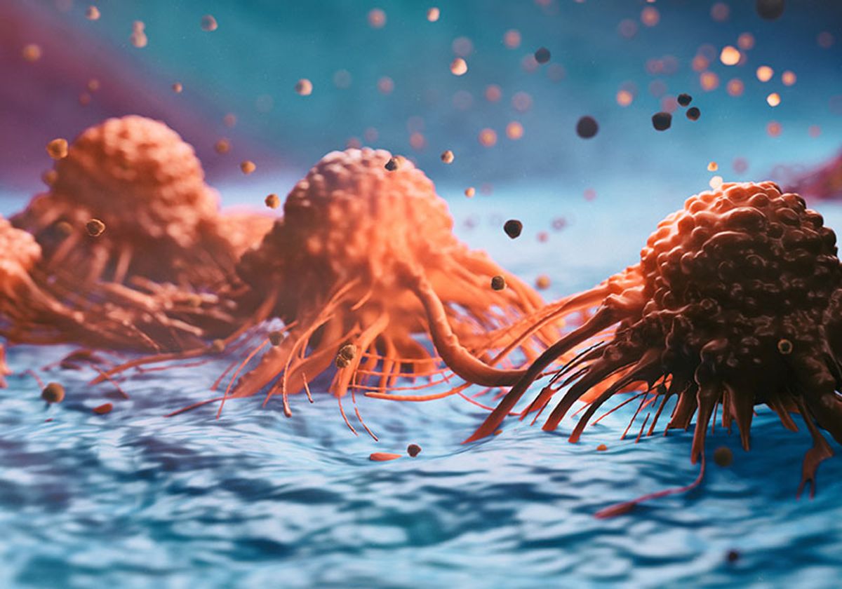 Những người dưới 50 tuổi ch&uacute; &yacute;: 6 triệu chứng n&agrave;y c&oacute; thể l&agrave; dấu hiệu của ung thư- Ảnh 1.