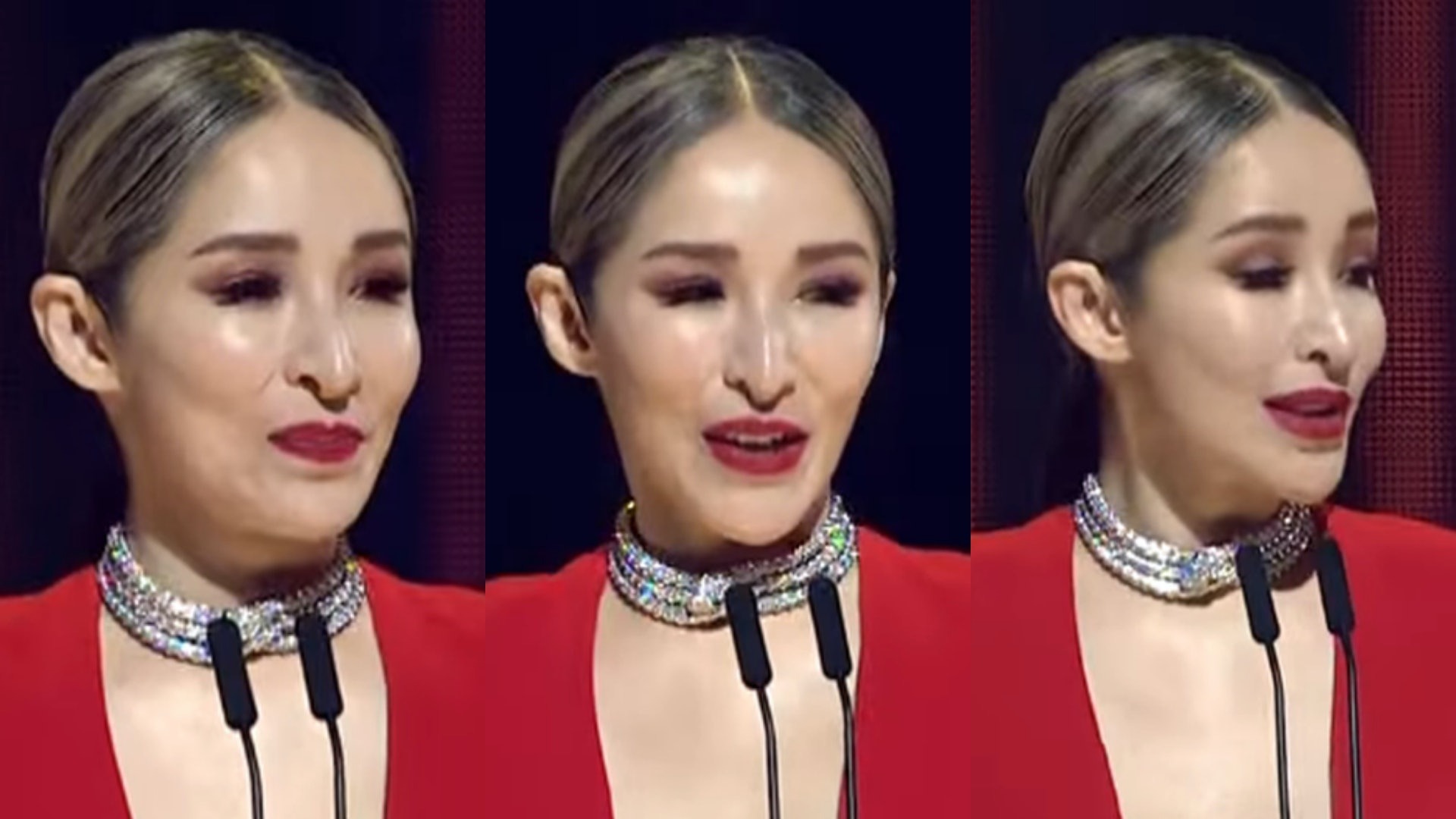 Nữ ca sĩ bị tai nạn đến hủy dung: Vết thương hoại tử 2 th&aacute;ng, giờ g&acirc;y sốc với 