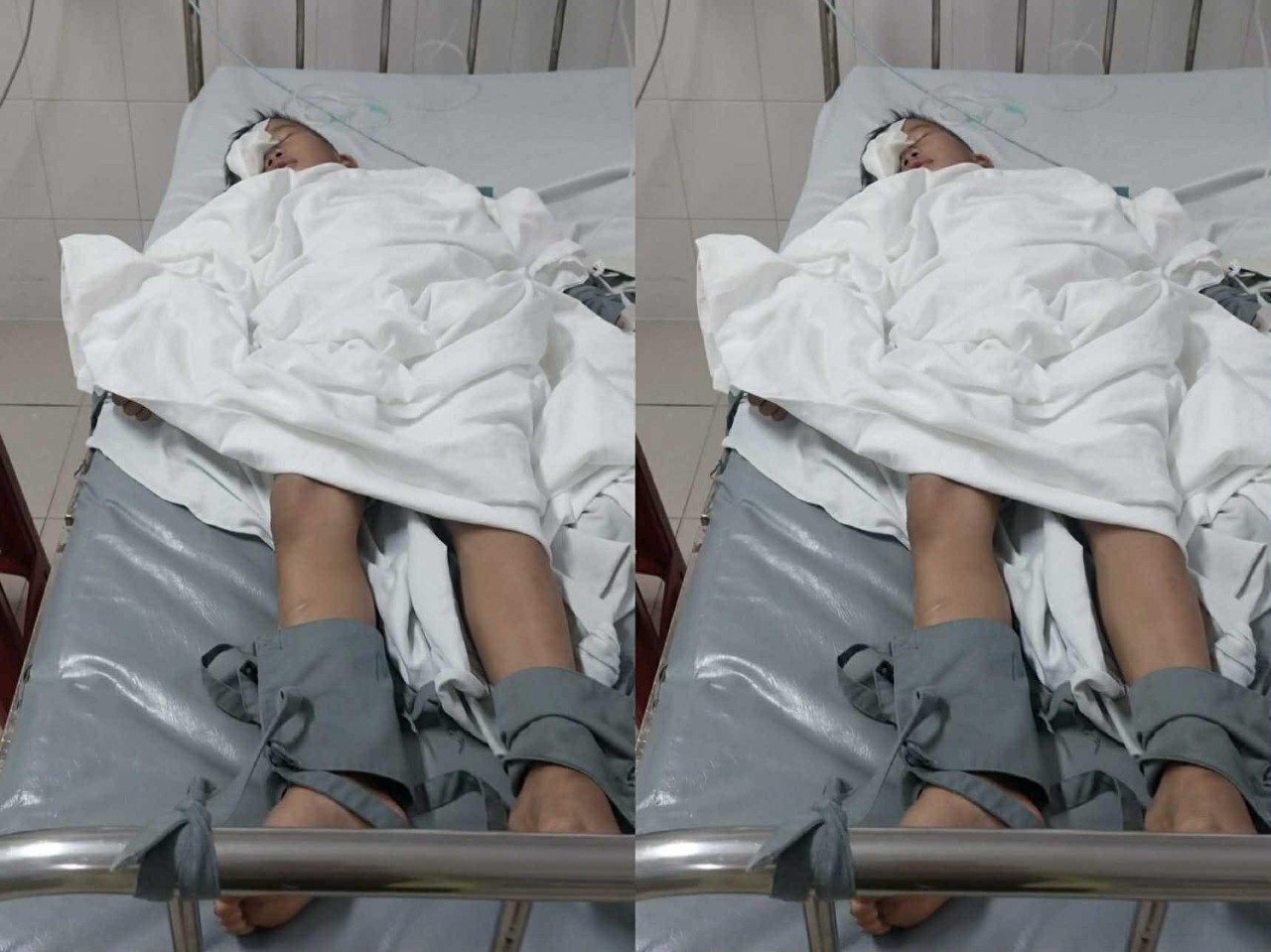 Phụ huynh tố c&aacute;o việc con lớp 1 bị bạn chọc tr&uacute;ng mắt, tổn thương nghi&ecirc;m trọng- Ảnh 1.