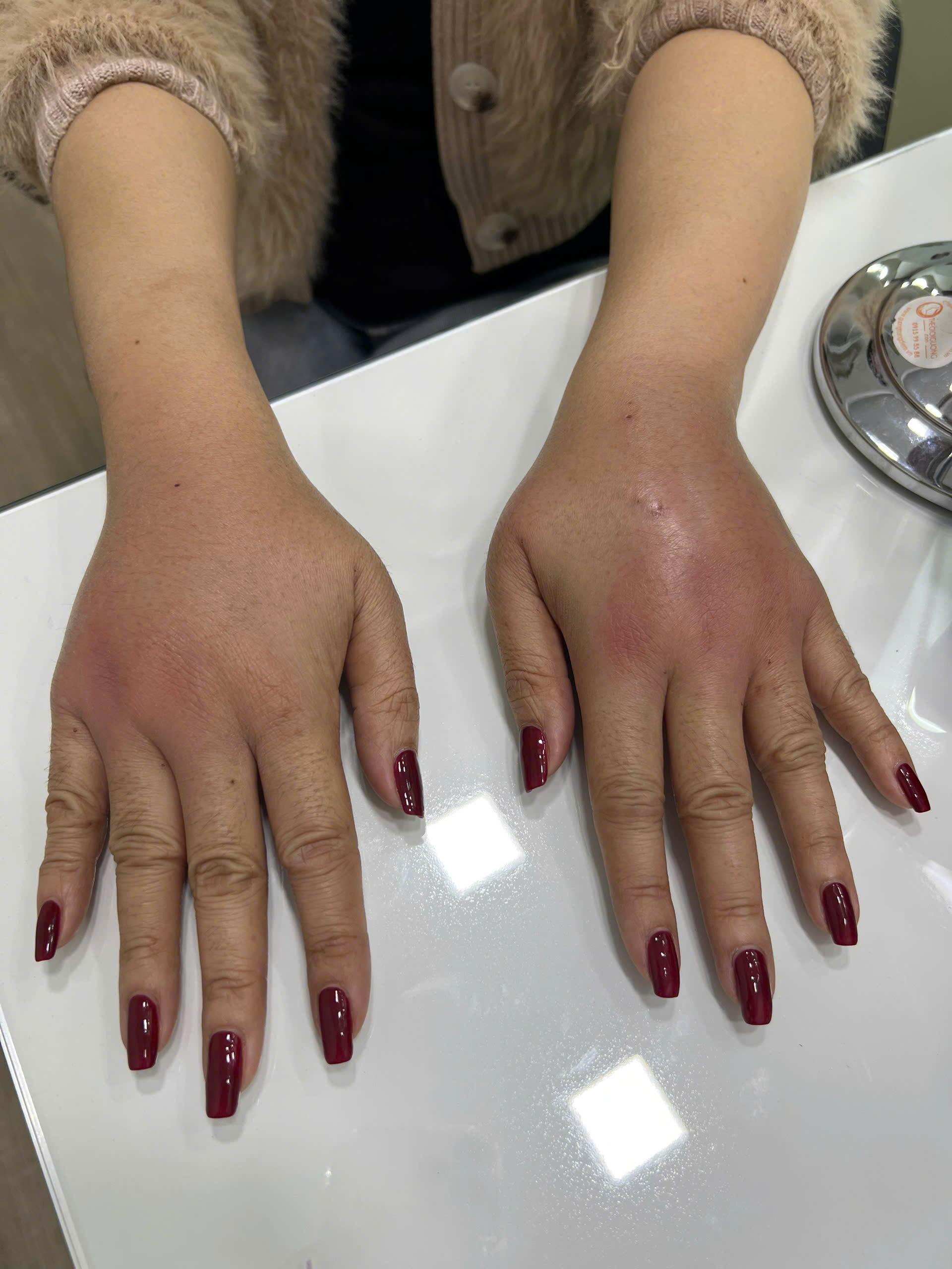 Tin quảng c&aacute;o &ldquo;bật t&ocirc;ng nhanh&rdquo;, nhiều người biến dạng mặt v&igrave; l&agrave;m đẹp cận Tết- Ảnh 2.