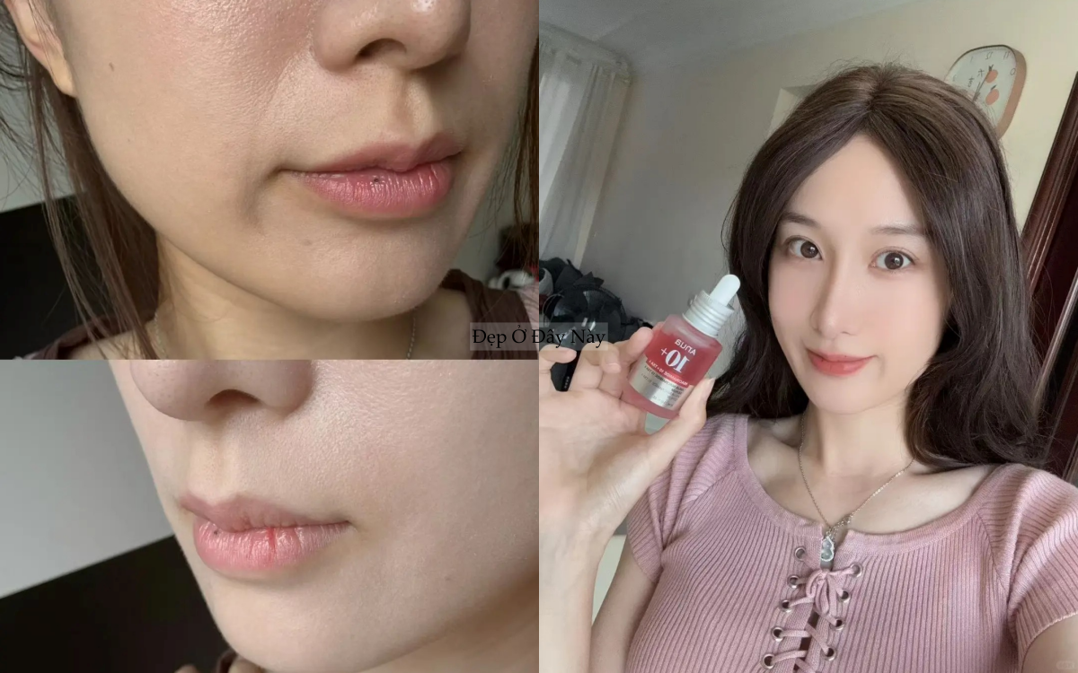 3 serum H&agrave;n Quốc l&agrave;m mờ th&acirc;m tốt nhất, khiến l&agrave;n da như "lột x&aacute;c" ho&agrave;n to&agrave;n- Ảnh 5.