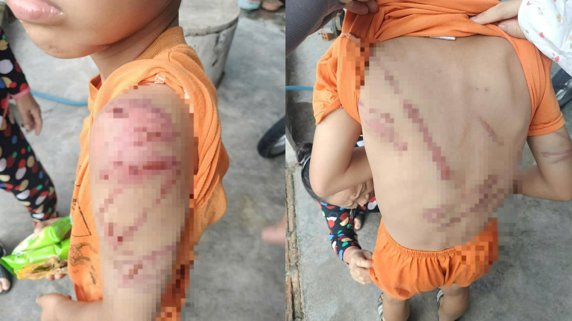 X&oacute;t xa h&igrave;nh ảnh ch&aacute;u trai nghi bị cha đ&aacute;nh bầm t&iacute;m khắp người- Ảnh 1.