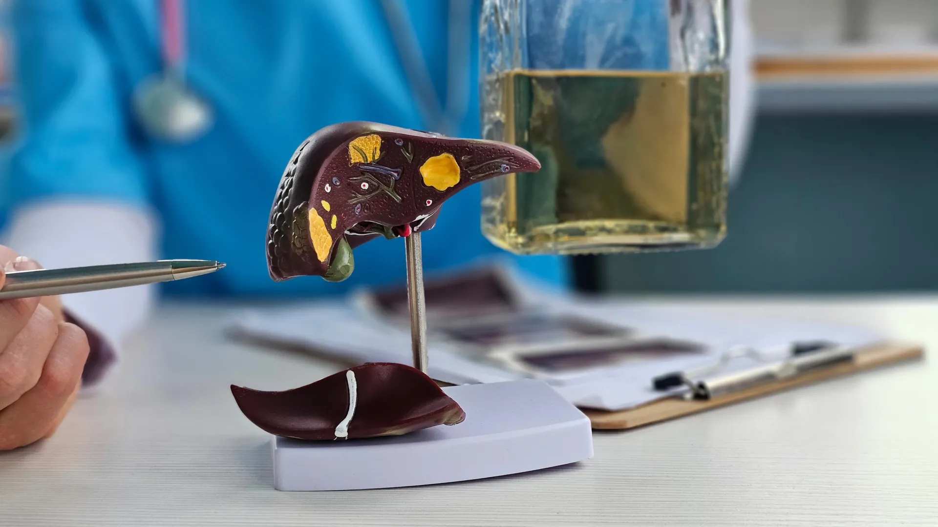 1 dấu hiệu cảnh b&aacute;o sớm bệnh gan chỉ xuất hiện v&agrave;o buổi tối- Ảnh 2.