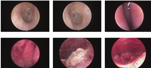 Sụt 5kg trong 1 th&aacute;ng, người đ&agrave;n &ocirc;ng 47 tuổi mắc c&ugrave;ng l&uacute;c 2 bệnh ung thư: Thủ phạm từ th&oacute;i quen uống 300ml loại đồ uống n&agrave;y mỗi ng&agrave;y- Ảnh 2.