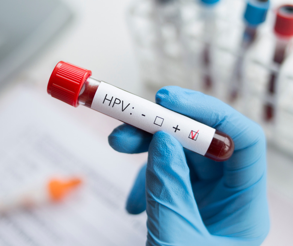 "Con chưa từng l&agrave;m chuyện ấy" v&agrave; c&acirc;u chuyện nữ sinh 17 tuổi lỡ dở tương lai v&igrave; ung thư cổ tử cung- Ảnh 2.