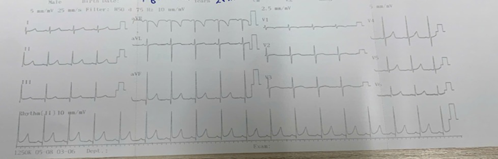 L&agrave;o Cai: B&eacute; 2 tuổi nhập viện v&igrave; nhịp tim hơn 285 lần/ph&uacute;t, b&aacute;c sĩ chỉ r&otilde; dấu hiệu bố mẹ cần đưa con đi kh&aacute;m ngay- Ảnh 2.