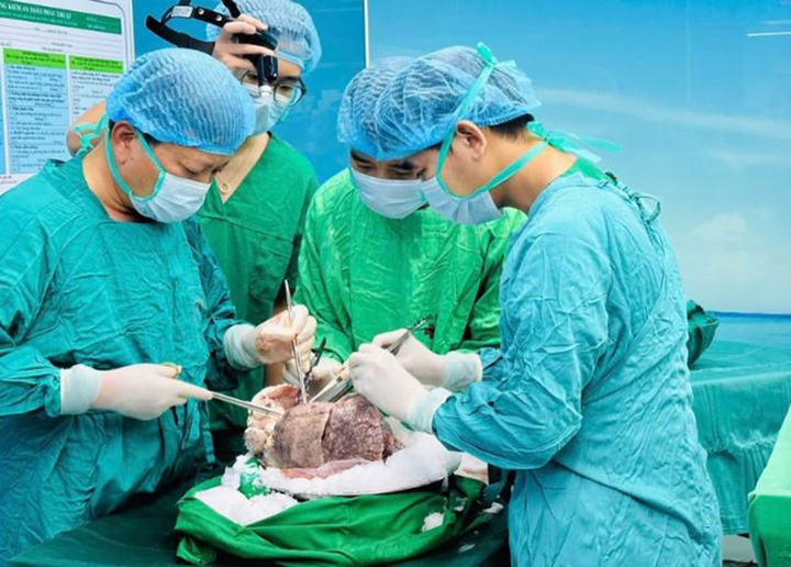 Chi ph&iacute; gh&eacute;p phổi rẻ hơn Mỹ 25 lần, Việt Nam 'tỏa s&aacute;ng' tr&ecirc;n bản đồ gh&eacute;p tạng- Ảnh 2.