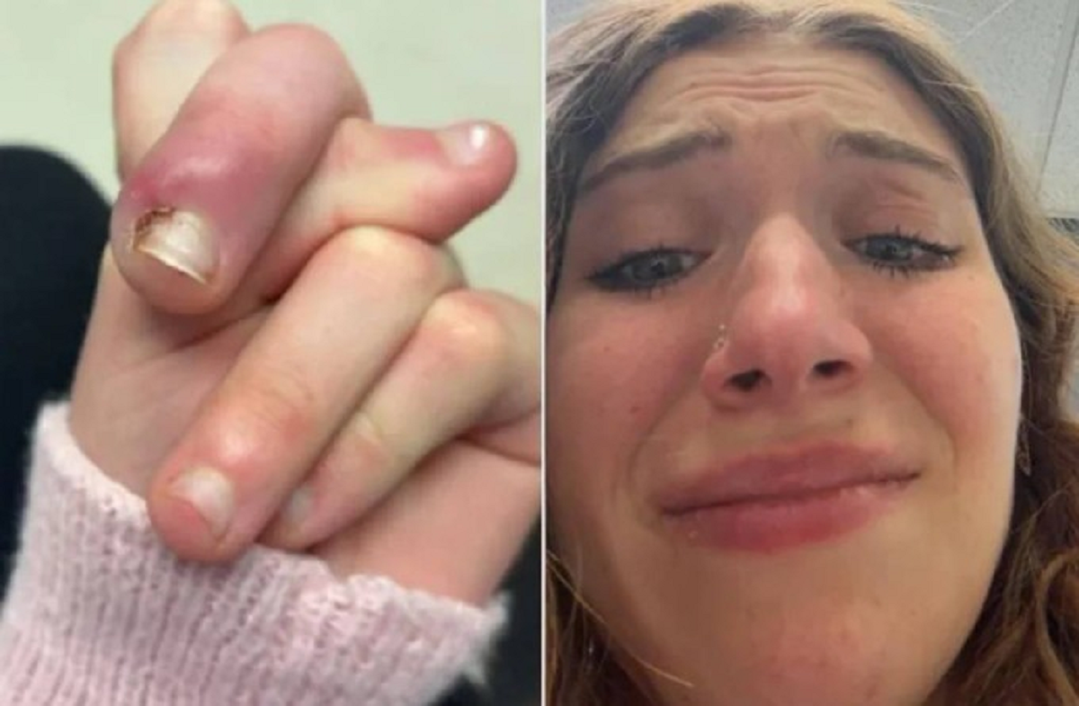 Người phụ nữ 21 tuổi su&yacute;t mất ng&oacute;n v&igrave; th&oacute;i quen "vạn người m&ecirc;"- Ảnh 1.