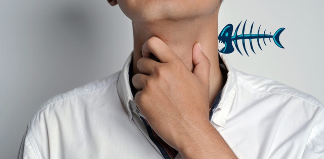 H&oacute;c xương c&aacute; phải l&agrave;m sao? Đừng nuốt cơm, l&agrave;m 2 c&aacute;ch n&agrave;y hiệu quả, ai cũng l&agrave;m được- Ảnh 2.