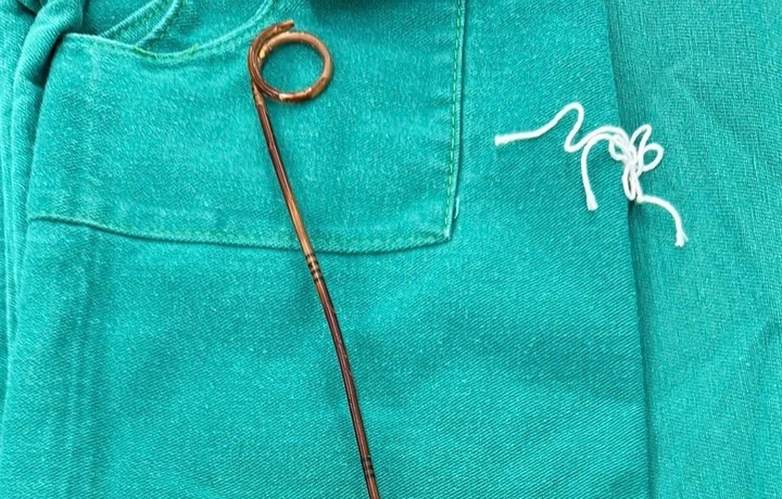 Qu&ecirc;n thiết bị y tế trong bụng suốt hai năm- Ảnh 1.