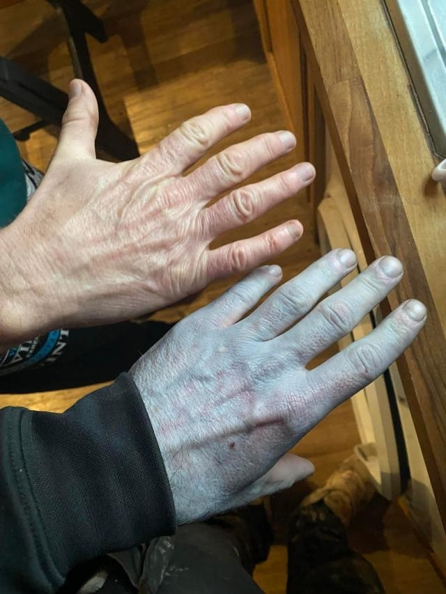 To&agrave;n th&acirc;n t&iacute;m t&aacute;i, người đ&agrave;n &ocirc;ng vội đến bệnh viện v&agrave; c&aacute;i kết- Ảnh 1.