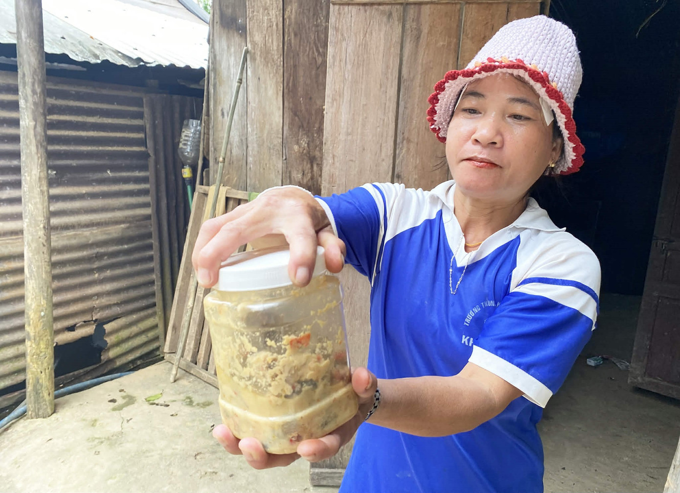 H&eacute; lộ nguy&ecirc;n nh&acirc;n m&oacute;n c&aacute; ủ chua khiến 3 trẻ ở Đ&agrave; Nẵng nguy kịch phải nhờ sự trợ gi&uacute;p từ WHO- Ảnh 1.