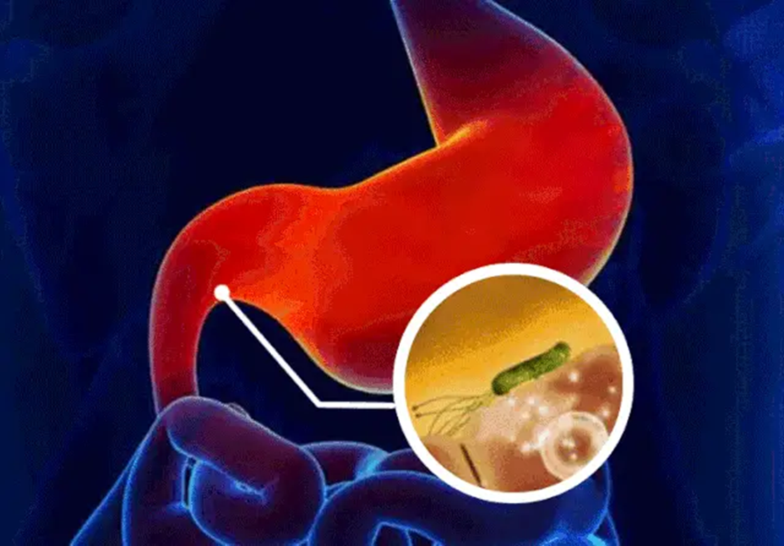 Nghi&ecirc;n cứu sinh tiến sĩ 23 tuổi đ&atilde; trải qua 10 đợt h&oacute;a trị v&igrave; ung thư dạ d&agrave;y giai đoạn cuối: Những dấu hiệu cơ thể kh&ocirc;ng n&ecirc;n xem nhẹ- Ảnh 4.