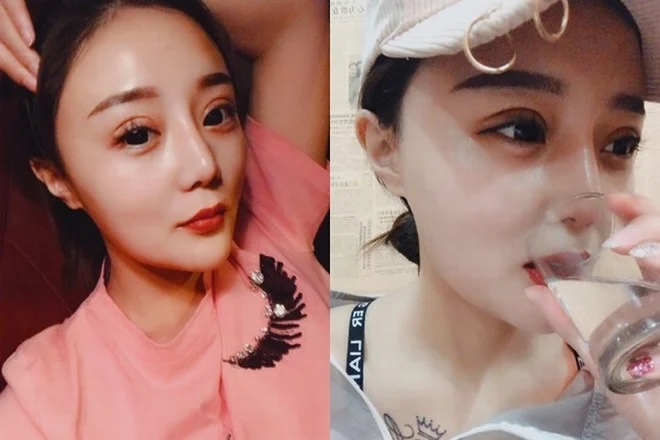 Cuộc sống sang chảnh hiện tại của &ldquo;c&ocirc; g&aacute;i bị h&oacute;i một mảng đầu v&igrave; ăn ng&ocirc; bằng khoan&rdquo; 10 năm trước- Ảnh 5.