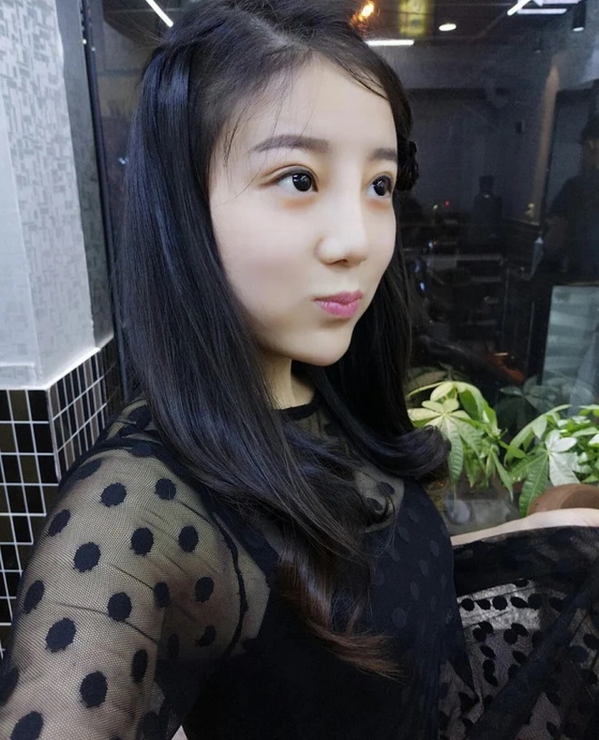 Cuộc sống sang chảnh hiện tại của &ldquo;c&ocirc; g&aacute;i bị h&oacute;i một mảng đầu v&igrave; ăn ng&ocirc; bằng khoan&rdquo; 10 năm trước- Ảnh 4.