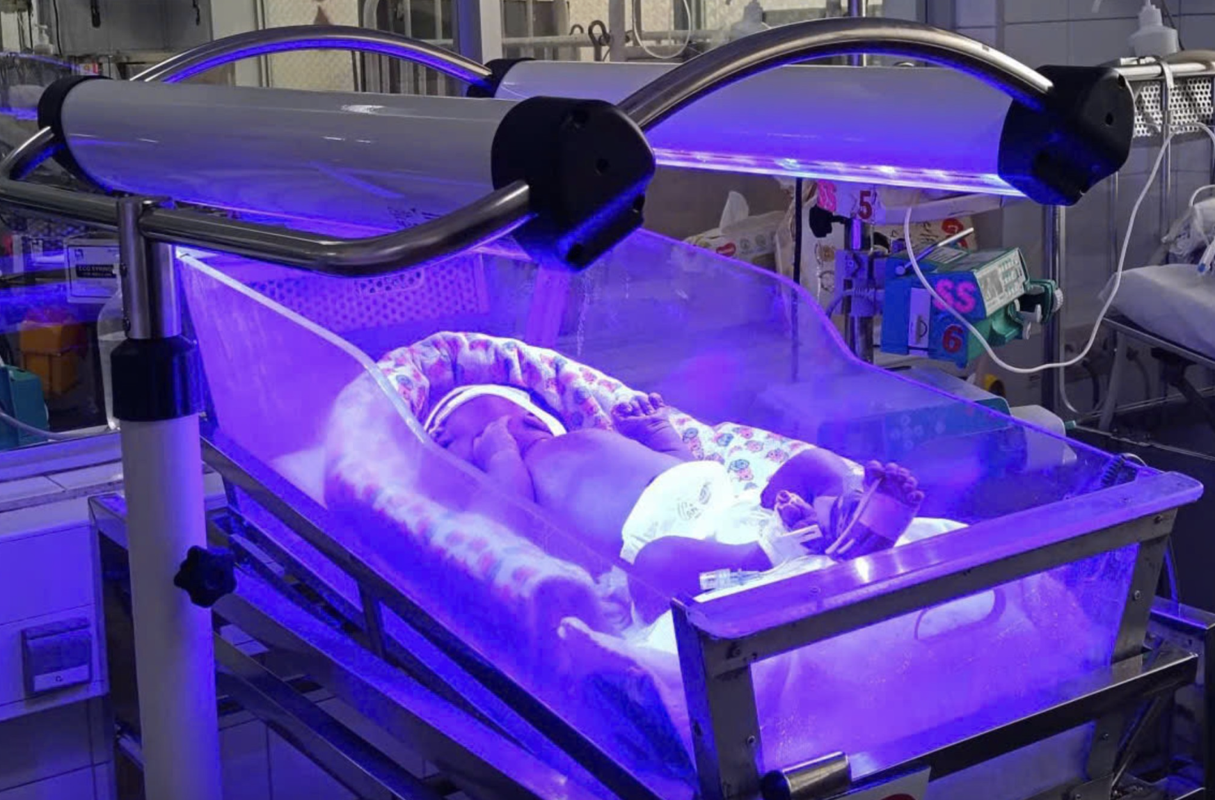 Cứu b&eacute; sơ sinh 30 giờ tuổi mang nh&oacute;m m&aacute;u hiếm ở TPHCM- Ảnh 1.