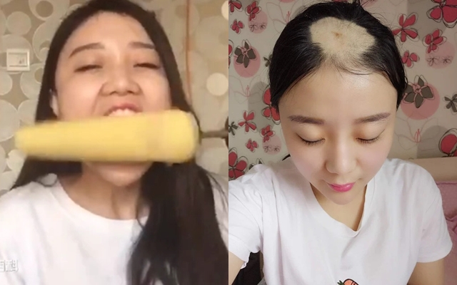 Cuộc sống sang chảnh hiện tại của &ldquo;c&ocirc; g&aacute;i bị h&oacute;i một mảng đầu v&igrave; ăn ng&ocirc; bằng khoan&rdquo; 10 năm trước- Ảnh 2.