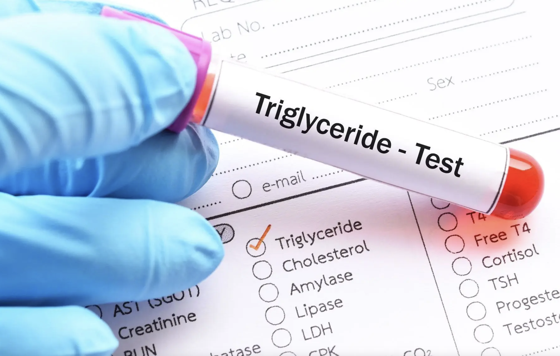 Người đàn ông U40 máu trắng đục như sữa, bác sĩ chỉ đích danh sai lầm khiến mỡ máu tăng vọt- Ảnh 1. Người đàn ông U40 máu trắng đục như sữa, bác sĩ chỉ đích danh sai lầm khiến mỡ máu tăng vọt- Ảnh 1.