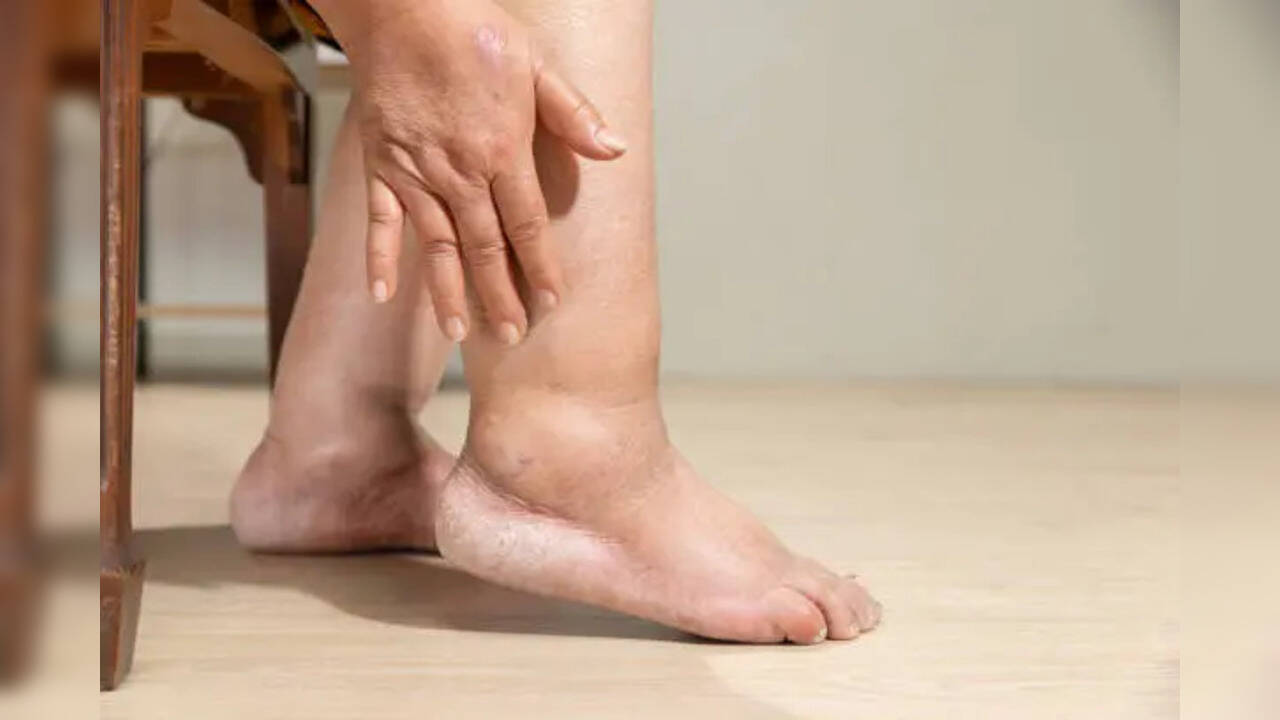 Muốn biết thận khỏe hay yếu, cứ nhìn vào tay và chân sẽ rõ: Có 7 dấu hiệu này thì phải đi khám sớm!- Ảnh 1. Muốn biết thận khỏe hay yếu, cứ nhìn vào tay và chân sẽ rõ: Có 7 dấu hiệu này thì phải đi khám sớm!- Ảnh 1.