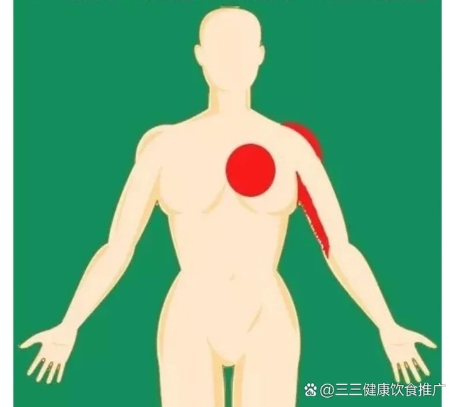 Kh&ocirc;ng chỉ đau ngực: 10 vị tr&iacute; đau "lạ" c&oacute; thể l&agrave; dấu hiệu nhồi m&aacute;u cơ tim, đ&aacute;ng tiếc nhiều người kh&ocirc;ng biết m&agrave; bỏ qua- Ảnh 3.