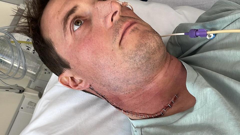 Người đàn ông suýt phải cắt bỏ lưỡi vì ung thư, nguyên nhân xuất phát từ căn bệnh nhiều người tưởng chỉ phụ nữ mới mắc- Ảnh 2. Người đàn ông suýt phải cắt bỏ lưỡi vì ung thư, nguyên nhân xuất phát từ căn bệnh nhiều người tưởng chỉ phụ nữ mới mắc- Ảnh 2.