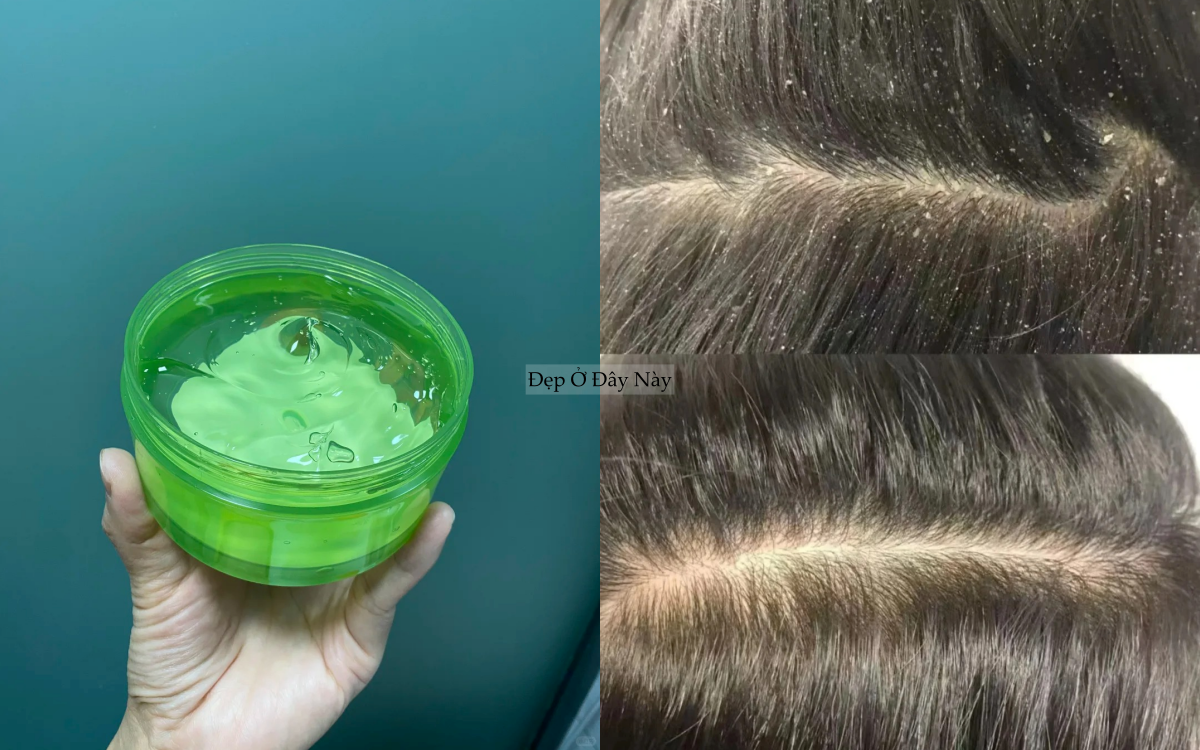 Thử thoa gel l&ocirc; hội l&ecirc;n t&oacute;c sau khi gội đầu, t&ocirc;i kh&ocirc;ng ngờ t&oacute;c hết sạch g&agrave;u v&agrave; giảm bết thấy r&otilde;- Ảnh 2.