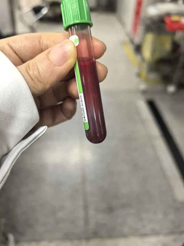 Mẹ bầu nghiện ăn g&agrave; r&aacute;n, hamburger, tăng 5kg chỉ sau 1 tuần, cả mẹ lẫn con phải đi cấp cứu- Ảnh 1.