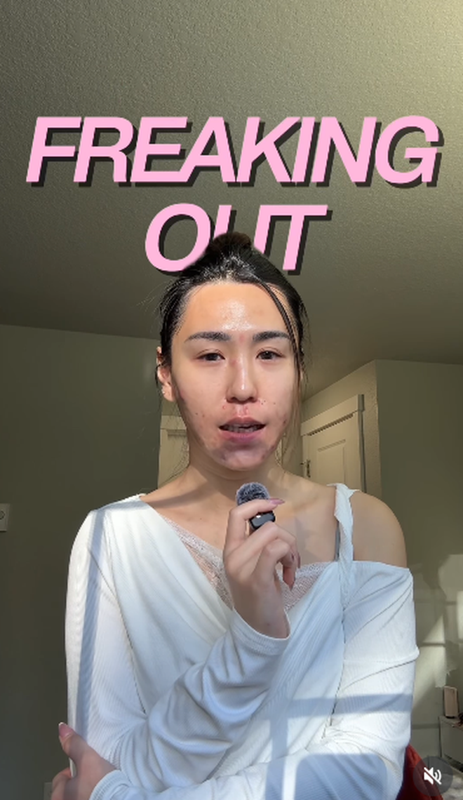 Bị đuổi việc, c&ocirc; g&aacute;i 27 tuổi để mặt mộc với mảng mụn lớn l&ecirc;n mạng t&acirc;m sự v&agrave; c&aacute;i kết bất ngờ- Ảnh 1.