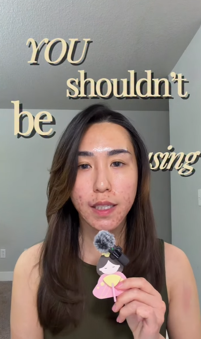 Bị đuổi việc, c&ocirc; g&aacute;i 27 tuổi để mặt mộc với mảng mụn lớn l&ecirc;n mạng t&acirc;m sự v&agrave; c&aacute;i kết bất ngờ- Ảnh 4.