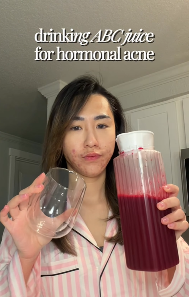 Bị đuổi việc, c&ocirc; g&aacute;i 27 tuổi để mặt mộc với mảng mụn lớn l&ecirc;n mạng t&acirc;m sự v&agrave; c&aacute;i kết bất ngờ- Ảnh 2.