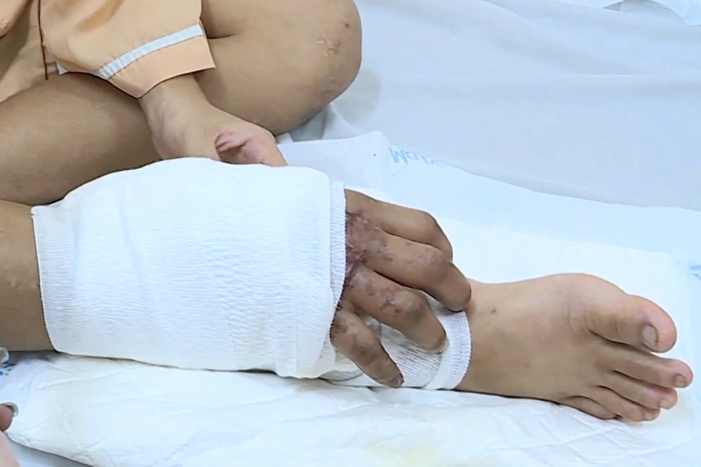 Từng g&acirc;y chấn động với ca gh&eacute;p b&agrave;n tay đứt l&igrave;a v&agrave;o ch&acirc;n khi đang mang song thai, cuộc sống hiện tại của người mẹ đơn th&acirc;n giờ ra sao?- Ảnh 2.