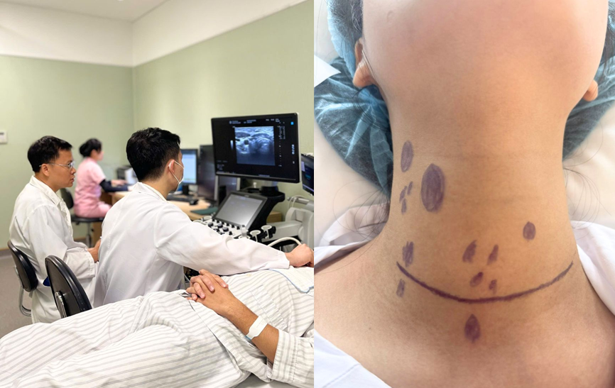 C&ocirc; g&aacute;i 24 tuổi ở H&agrave; Nội ph&aacute;t hiện ung thư tuyến gi&aacute;p di căn hơn 20 hạch sau khi sờ thấy 1 thứ ở cổ