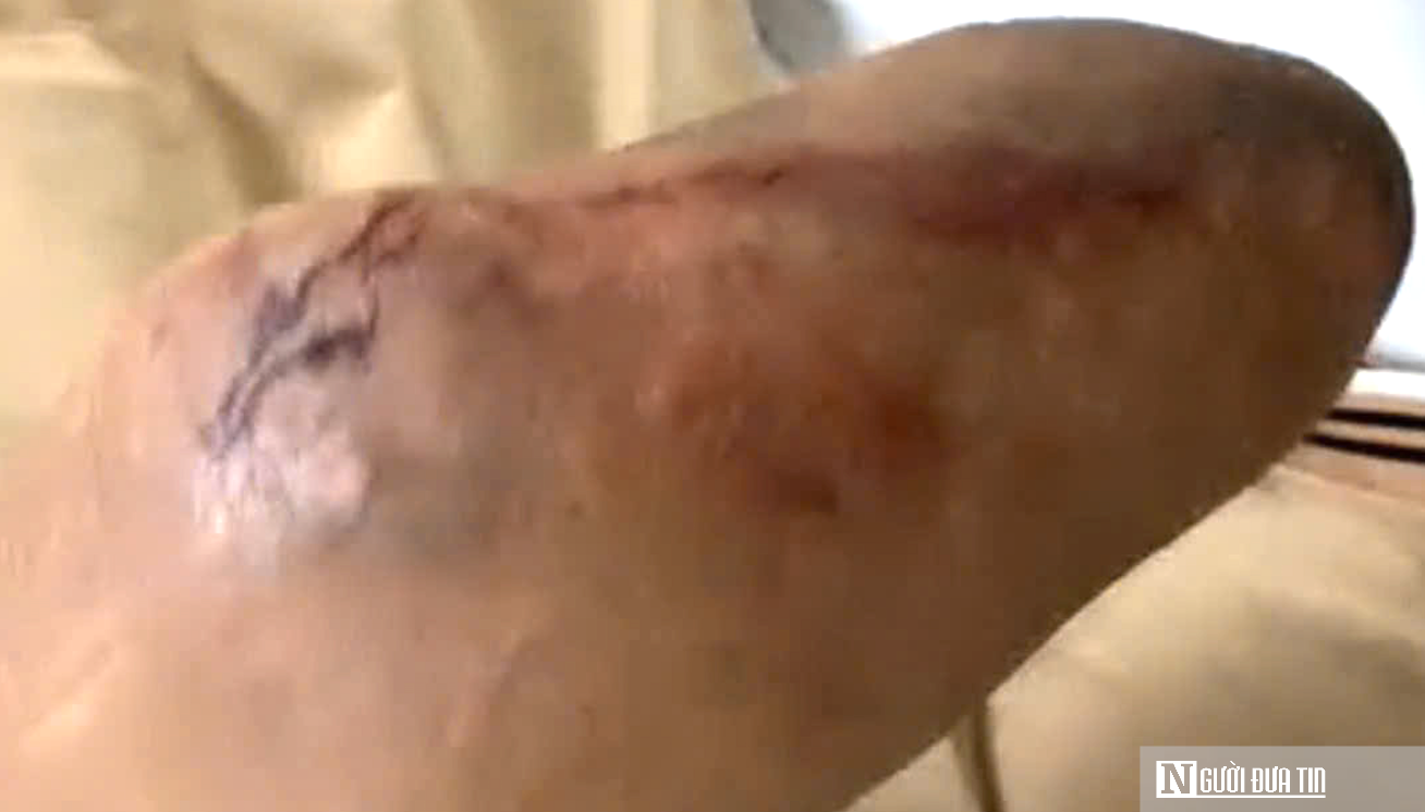 Cụ &ocirc;ng bị hổ mang cắn vẫn cố giữ chặt con rắn, c&acirc;u chuyện ph&iacute;a sau khiến nhiều người nghẹn l&ograve;ng- Ảnh 2.