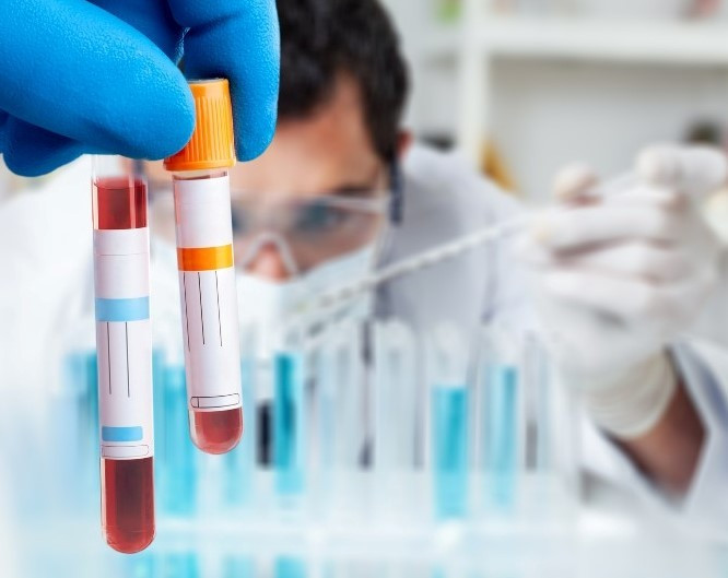 Sốt xuất huyết diễn biến kh&oacute; đo&aacute;n, nhiều ca chuyển nặng nhanh- Ảnh 2.