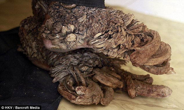 42 năm cuộc đời đầy bi kịch của "người c&acirc;y"- Ảnh 7.