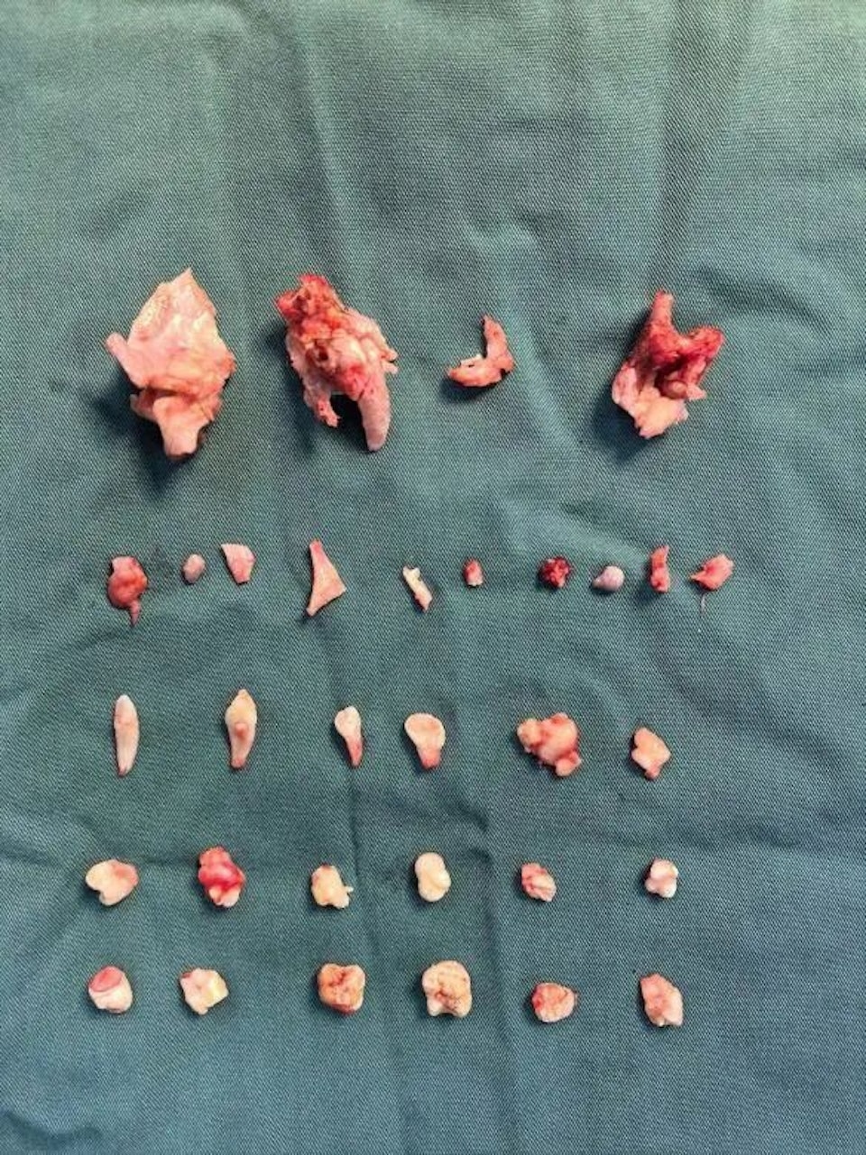 C&ocirc; g&aacute;i đau bụng dữ dội, b&aacute;c sĩ ph&aacute;t hiện ra b&iacute; mật b&ecirc;n trong- Ảnh 1.