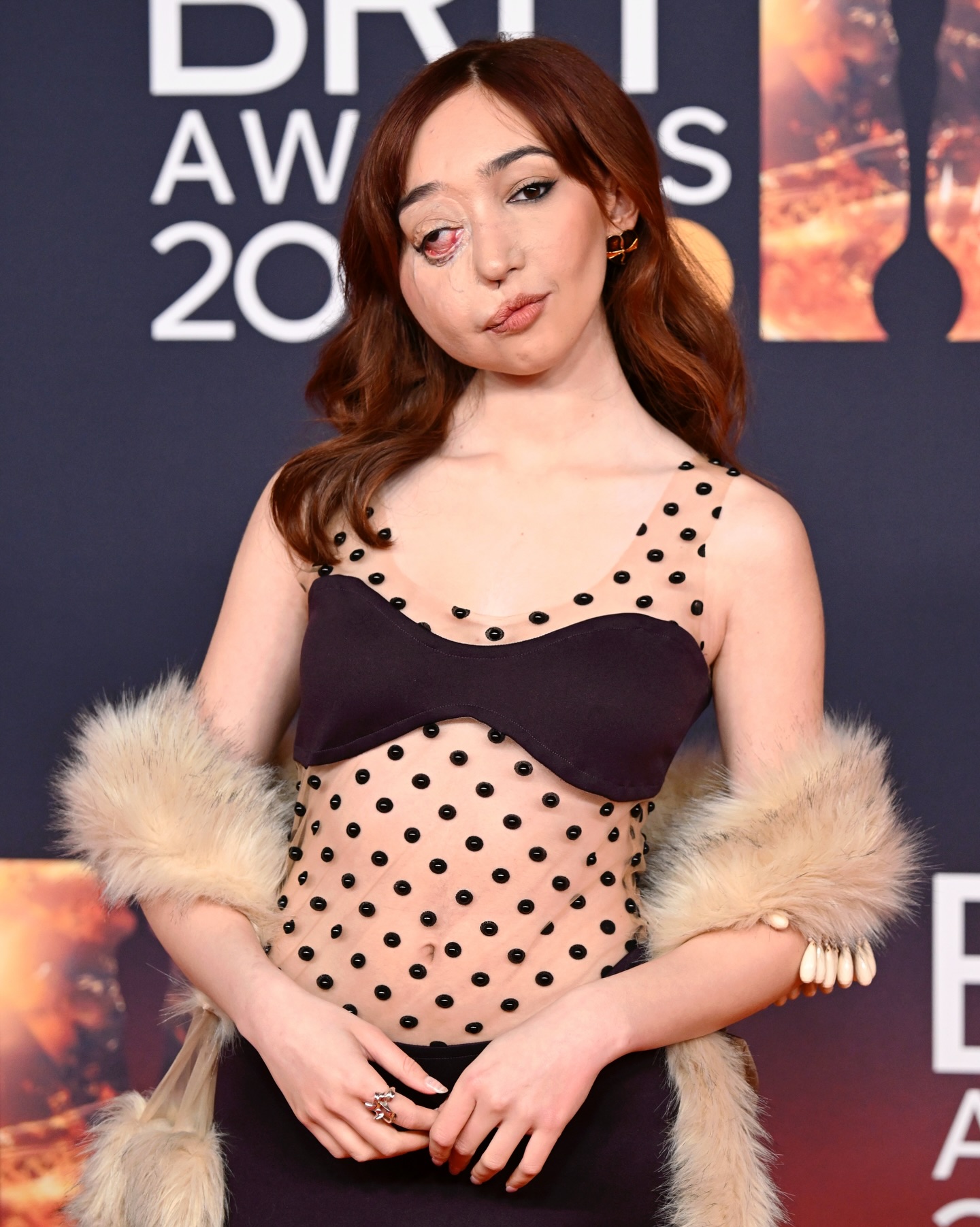 "Thi&ecirc;n nga trắng" hot nhất Oscar 2026: Một gương mặt biến dạng lại thu h&uacute;t hơn 13 triệu lượt xem- Ảnh 6.