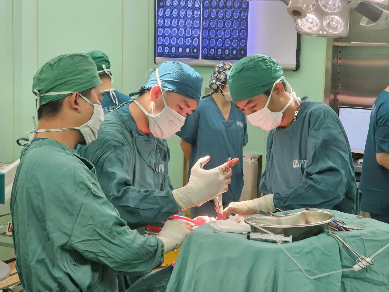 Xuy&ecirc;n đ&ecirc;m cứu bệnh nh&acirc;n nguy kịch v&igrave; chấn thương sọ n&atilde;o- Ảnh 1.