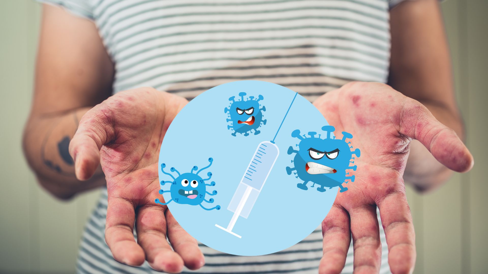 Vắc-xin ph&ograve;ng tay ch&acirc;n miệng ch&iacute;nh thức được Bộ Y tế cấp ph&eacute;p lưu h&agrave;nh tại Việt Nam- Ảnh 1.