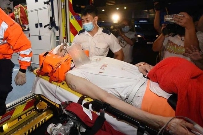 Nam nghệ sĩ bị m&agrave;n h&igrave;nh LED 600kg rơi tr&uacute;ng l&acirc;m v&agrave;o thảm cảnh t&agrave;n tật, bạn g&aacute;i hủy h&ocirc;n chia tay- Ảnh 2.