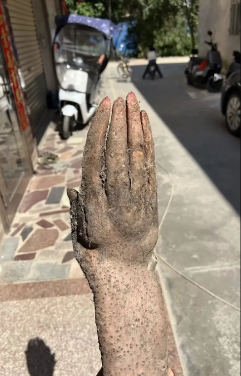 Đ&agrave;o được nguy&ecirc;n 