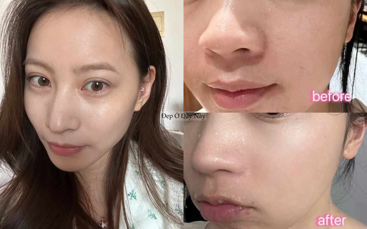 T&aacute;i sinh l&agrave;n da trong giấc ngủ với 5 lọ serum đ&ecirc;m gi&aacute; b&igrave;nh d&acirc;n ai d&ugrave;ng cũng khen- Ảnh 1.