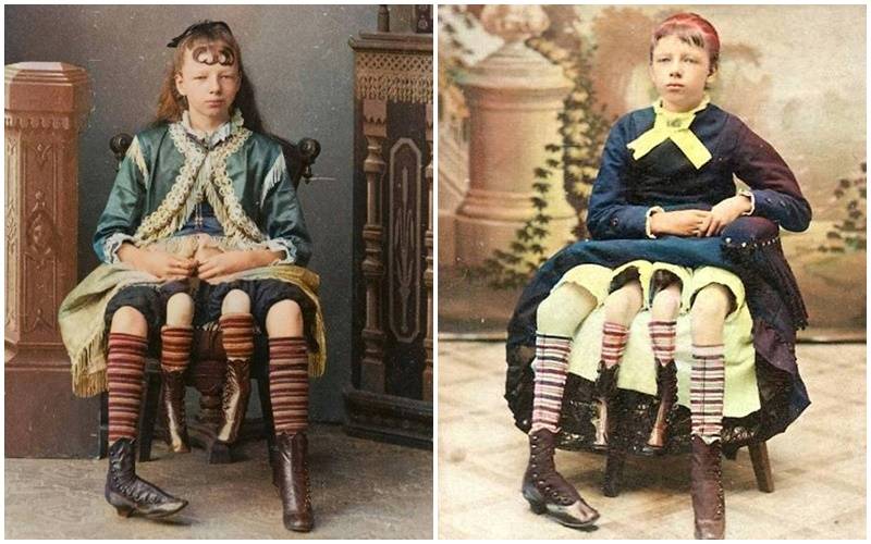 C&ocirc; g&aacute;i 4 ch&acirc;n, 2 "v&ugrave;ng k&iacute;n": 13 tuổi th&agrave;nh đại minh tinh với cuộc h&ocirc;n nh&acirc;n b&iacute; ẩn- Ảnh 2.